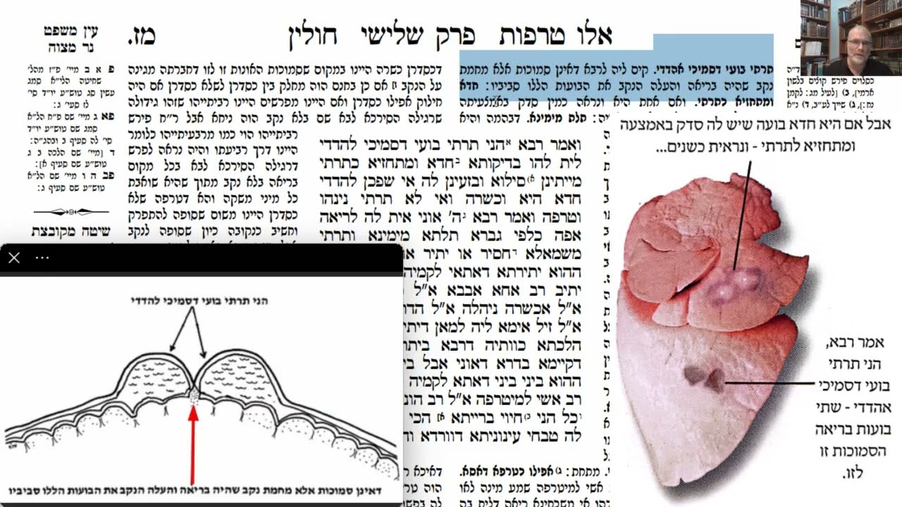 Read more about the article דף מז