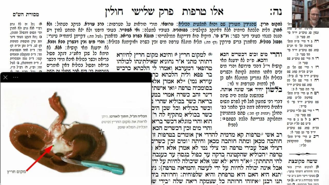 Read more about the article דף נה