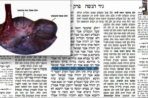 דף צג